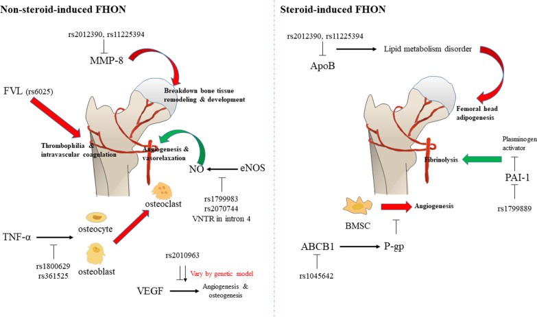 【佳学基因检测】股骨头坏死的基因解码及其基因检测