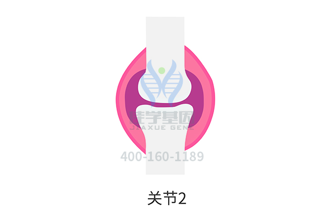 【佳学基因检测】怎么确定关节炎早期筛查基因检测的基因列表? 【佳学基因检测】怎么确定关节炎早期筛查基因检测的基因列表?