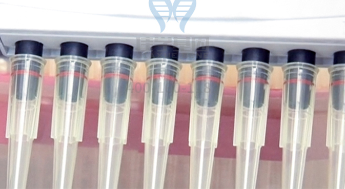 【佳学基因检测】食管鳞状细胞癌基因解码、基因检测